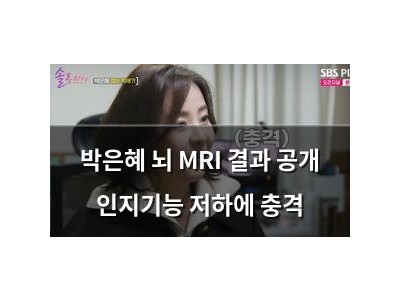 박은혜 뇌 MRI 결과 공개 인지기능 저하에 충격